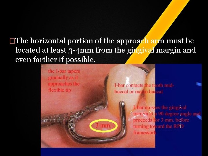 �The horizontal portion of the approach arm must be located at least 3 -4 �The horizontal portion of the approach arm must be located at least 3 -4