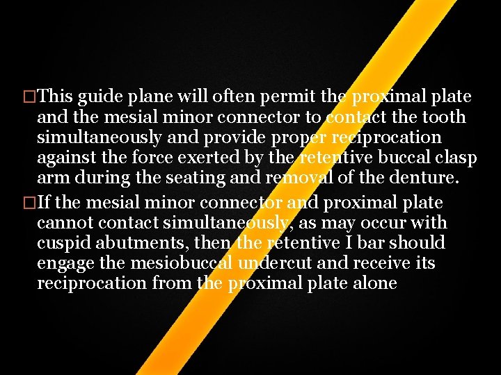 �This guide plane will often permit the proximal plate and the mesial minor connector �This guide plane will often permit the proximal plate and the mesial minor connector
