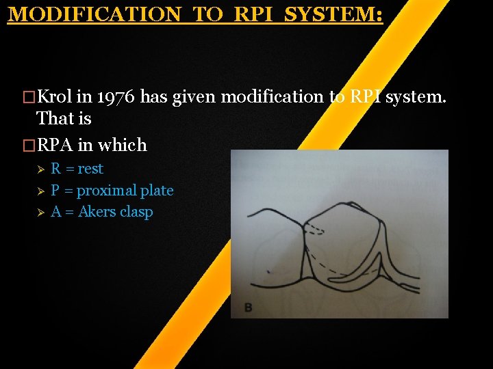 MODIFICATION TO RPI SYSTEM: �Krol in 1976 has given modification to RPI system. That MODIFICATION TO RPI SYSTEM: �Krol in 1976 has given modification to RPI system. That