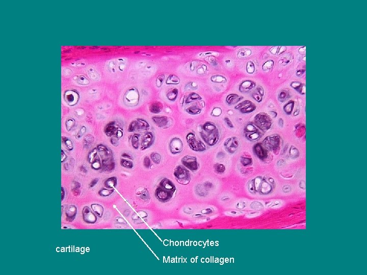 cartilage Chondrocytes Matrix of collagen 