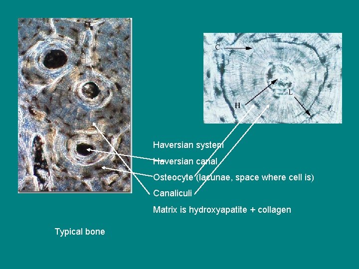 Haversian system Haversian canal Osteocyte (lacunae, space where cell is) Canaliculi Matrix is hydroxyapatite