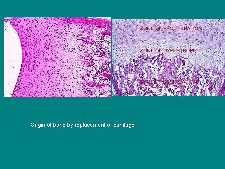 Origin of bone by replacement of cartilage 