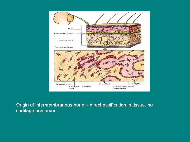 Origin of intermembranous bone = direct ossification in tissue, no cartilage precursor 