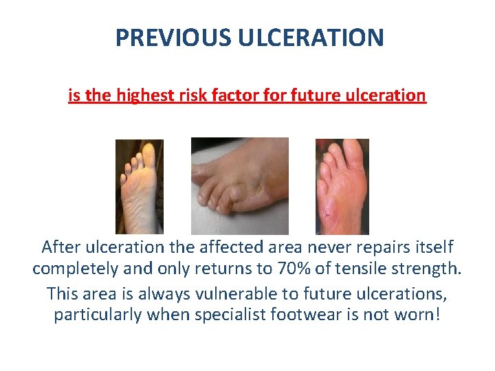 PREVIOUS ULCERATION is the highest risk factor future ulceration After ulceration the affected area