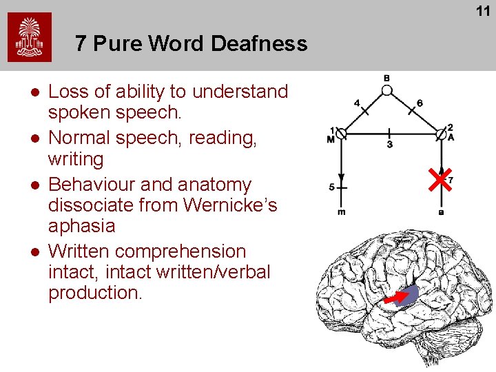 11 7 Pure Word Deafness l l Loss of ability to understand spoken speech. 11 7 Pure Word Deafness l l Loss of ability to understand spoken speech.