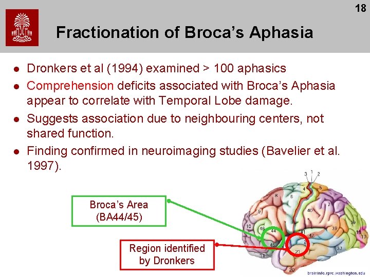18 Fractionation of Broca’s Aphasia l l Dronkers et al (1994) examined > 100 18 Fractionation of Broca’s Aphasia l l Dronkers et al (1994) examined > 100