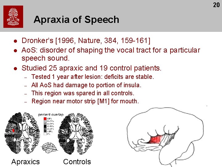 20 Apraxia of Speech l l l Dronker’s [1996, Nature, 384, 159 -161] Ao.