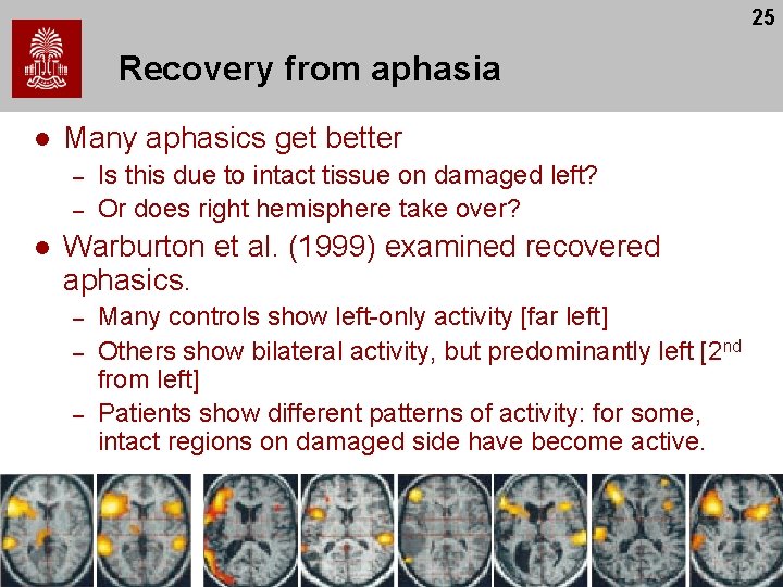 25 Recovery from aphasia l Many aphasics get better – – l Is this 25 Recovery from aphasia l Many aphasics get better – – l Is this