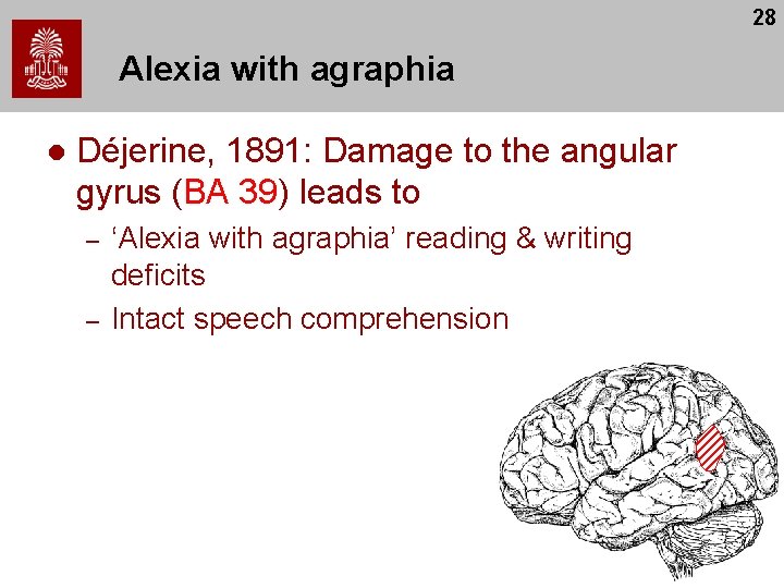 28 Alexia with agraphia l Déjerine, 1891: Damage to the angular gyrus (BA 39) 28 Alexia with agraphia l Déjerine, 1891: Damage to the angular gyrus (BA 39)