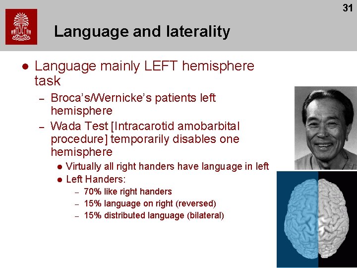 31 Language and laterality l Language mainly LEFT hemisphere task – – Broca’s/Wernicke’s patients 31 Language and laterality l Language mainly LEFT hemisphere task – – Broca’s/Wernicke’s patients