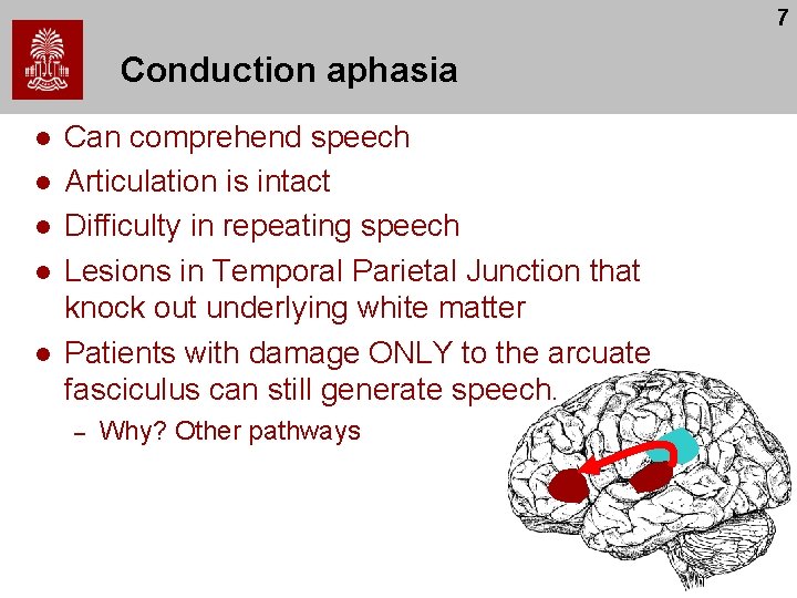 7 Conduction aphasia l l l Can comprehend speech Articulation is intact Difficulty in 7 Conduction aphasia l l l Can comprehend speech Articulation is intact Difficulty in