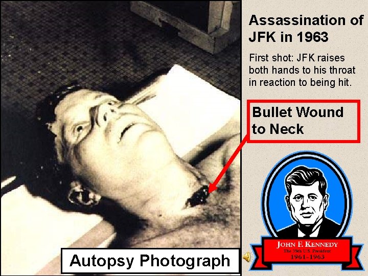 Assassination of JFK in 1963 First shot: JFK raises both hands to his throat