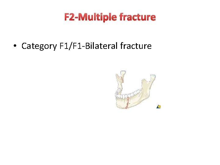 F 2 -Multiple fracture • Category F 1/F 1 -Bilateral fracture 