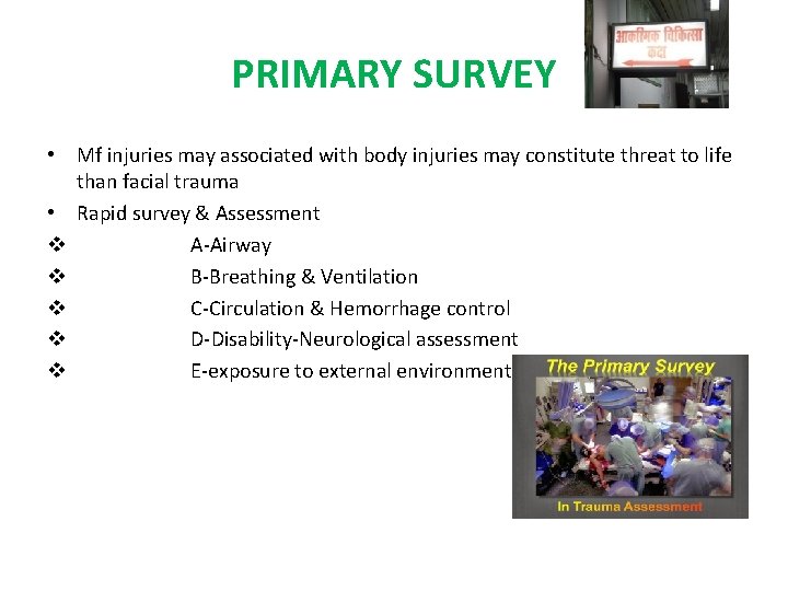 PRIMARY SURVEY • Mf injuries may associated with body injuries may constitute threat to