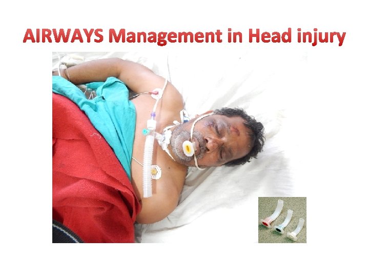 AIRWAYS Management in Head injury 