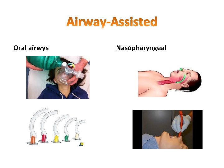 Oral airwys Nasopharyngeal 