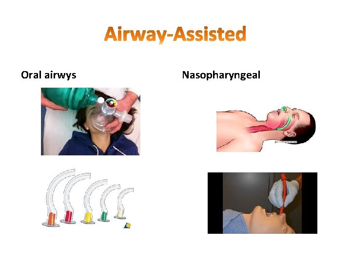 Oral airwys Nasopharyngeal Oral airwys Nasopharyngeal