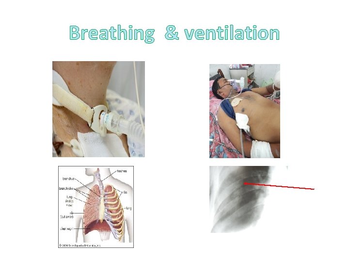 Breathing & ventilation Breathing & ventilation