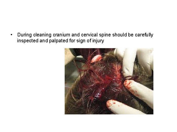  • During cleaning cranium and cervical spine should be carefully inspected and palpated