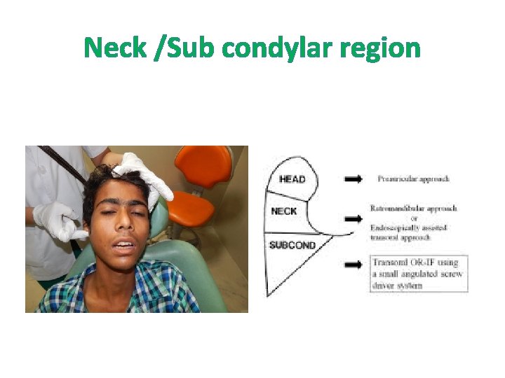 Neck /Sub condylar region 