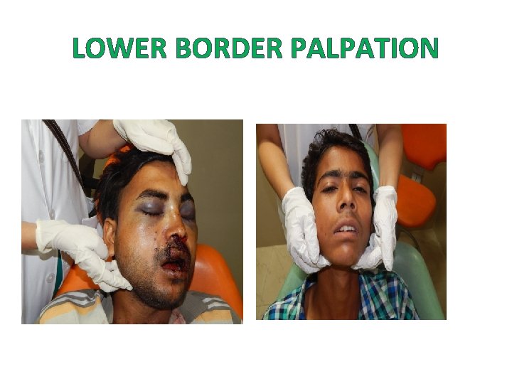 LOWER BORDER PALPATION 