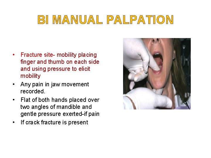 BI MANUAL PALPATION • Fracture site- mobility placing finger and thumb on each side