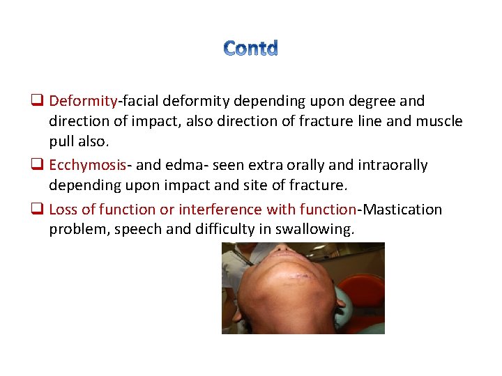 q Deformity-facial deformity depending upon degree and direction of impact, also direction of fracture