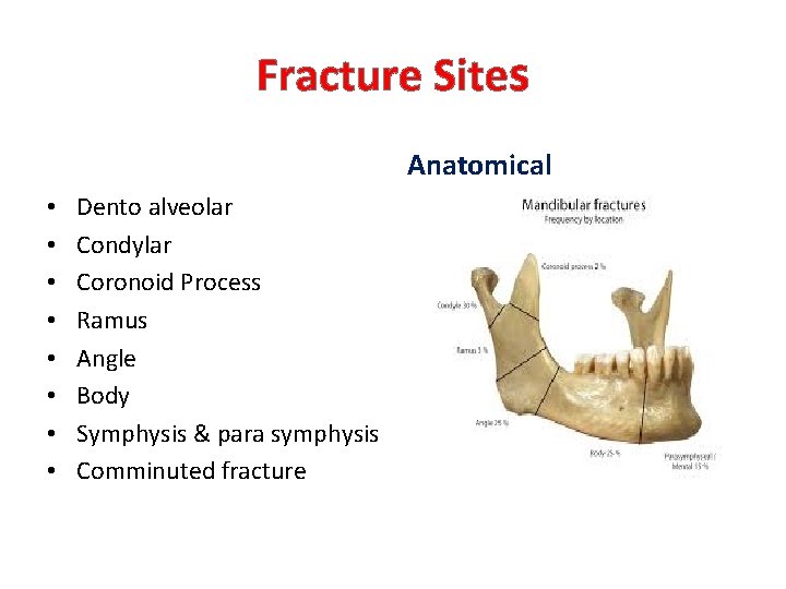Fracture Sites Anatomical • • Dento alveolar Condylar Coronoid Process Ramus Angle Body Symphysis Fracture Sites Anatomical • • Dento alveolar Condylar Coronoid Process Ramus Angle Body Symphysis