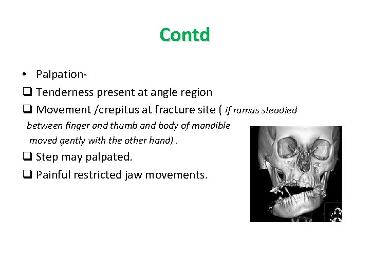 Contd • Palpationq Tenderness present at angle region q Movement /crepitus at fracture site Contd • Palpationq Tenderness present at angle region q Movement /crepitus at fracture site