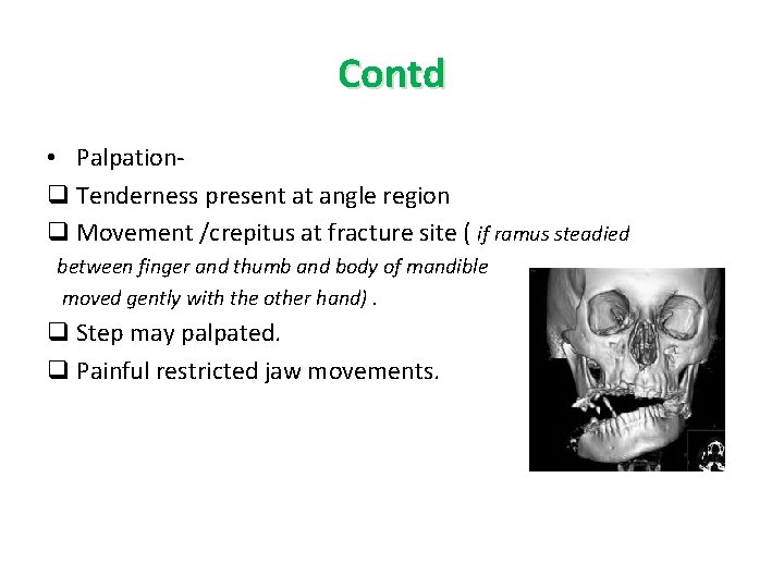 Contd • Palpationq Tenderness present at angle region q Movement /crepitus at fracture site