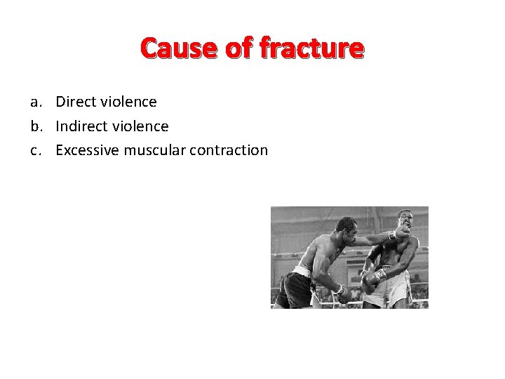 Cause of fracture a. Direct violence b. Indirect violence c. Excessive muscular contraction 