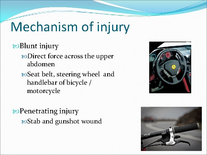 Mechanism of injury Blunt injury Direct force across the upper abdomen Seat belt, steering