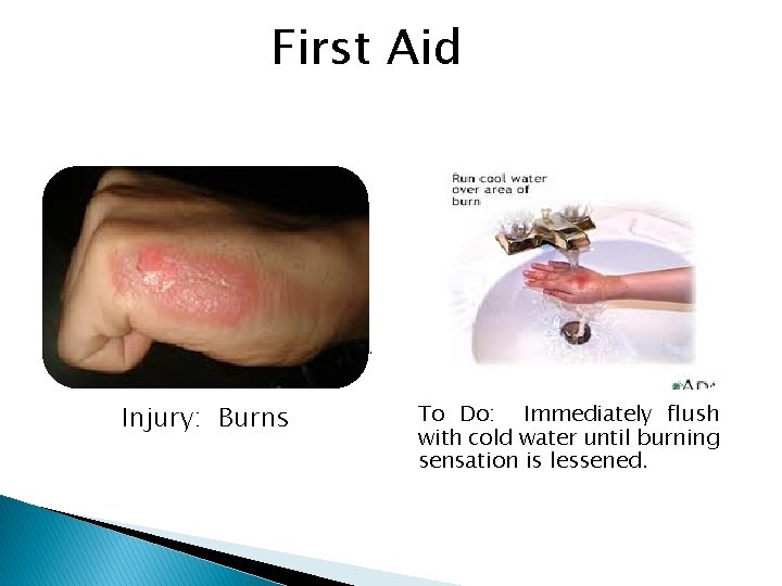 First Aid Injury: Burns To Do: Immediately flush with cold water until burning sensation