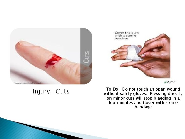Injury: Cuts To Do: Do not touch an open wound without safety gloves. Pressing