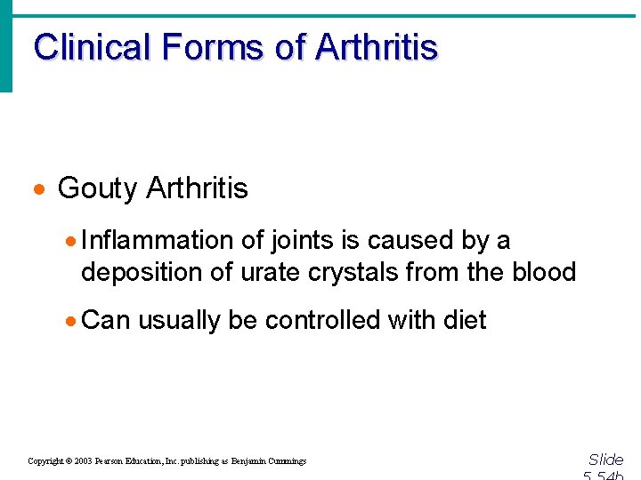 Clinical Forms of Arthritis · Gouty Arthritis · Inflammation of joints is caused by