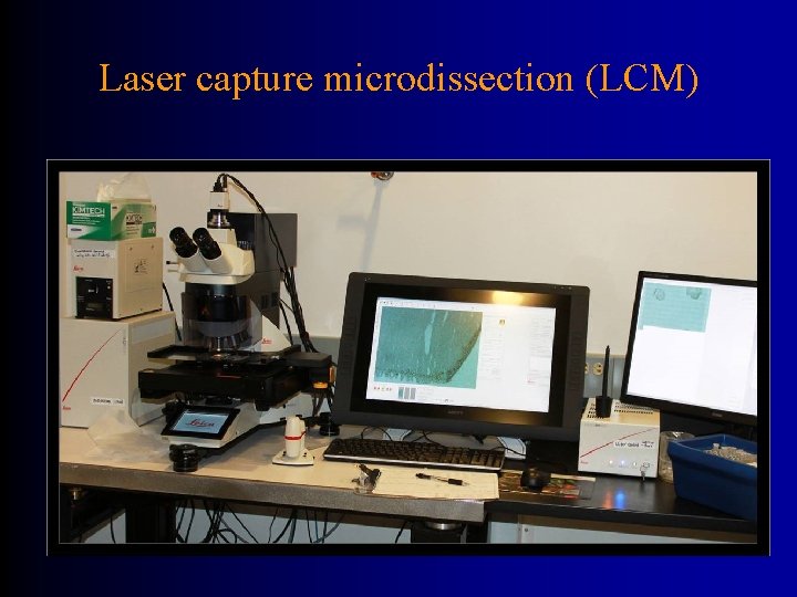 Laser capture microdissection (LCM) 