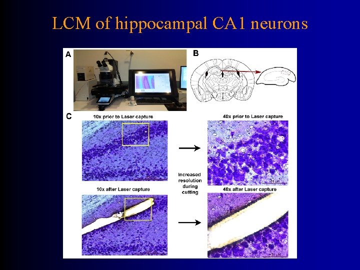 LCM of hippocampal CA 1 neurons 