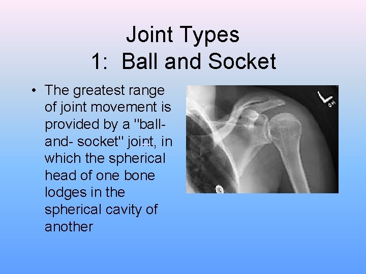 Joint Types 1: Ball and Socket • The greatest range of joint movement is