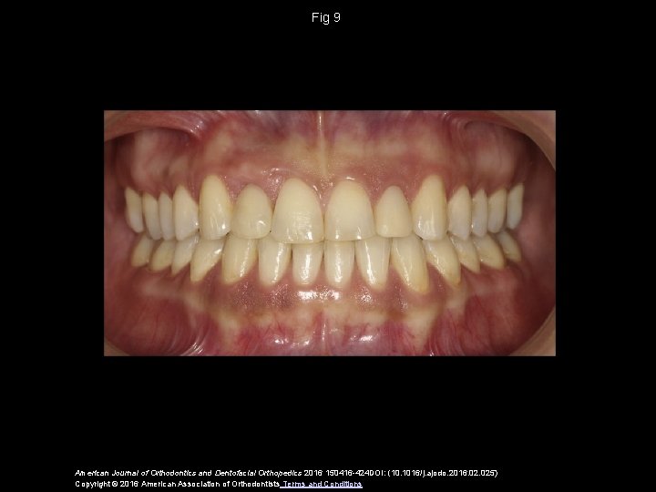 Fig 9 American Journal of Orthodontics and Dentofacial Orthopedics 2016 150416 -424 DOI: (10.