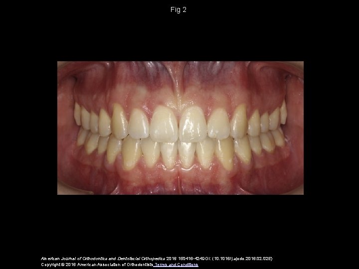 Fig 2 American Journal of Orthodontics and Dentofacial Orthopedics 2016 150416 -424 DOI: (10.