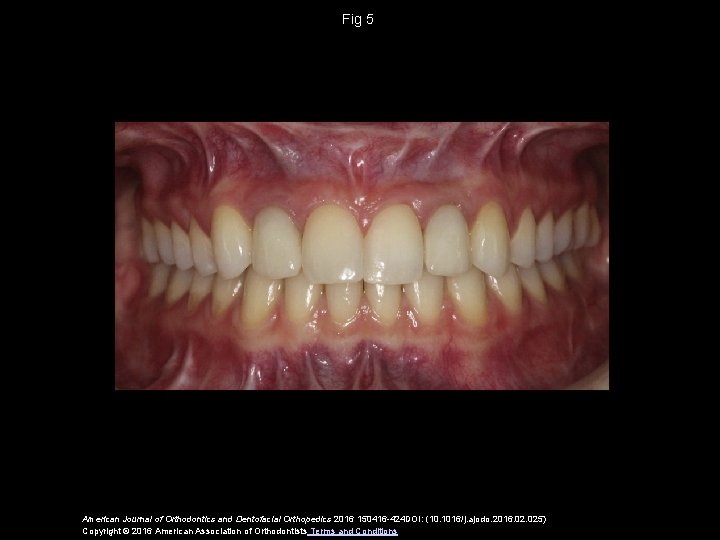 Fig 5 American Journal of Orthodontics and Dentofacial Orthopedics 2016 150416 -424 DOI: (10.