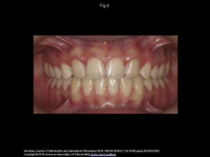 Fig 6 American Journal of Orthodontics and Dentofacial Orthopedics 2016 150416 -424 DOI: (10.