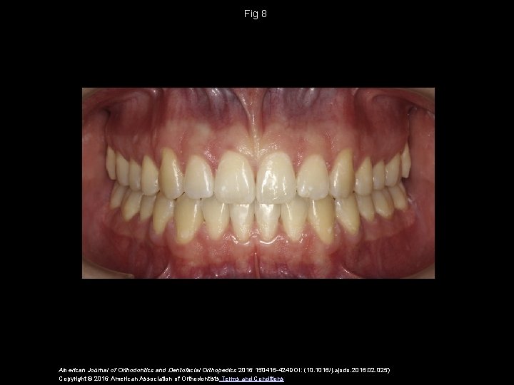 Fig 8 American Journal of Orthodontics and Dentofacial Orthopedics 2016 150416 -424 DOI: (10.