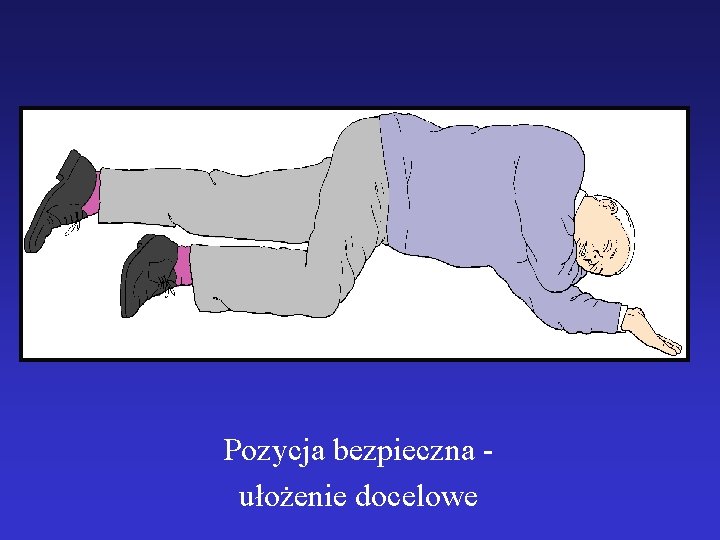 Pozycja bezpieczna ułożenie docelowe 