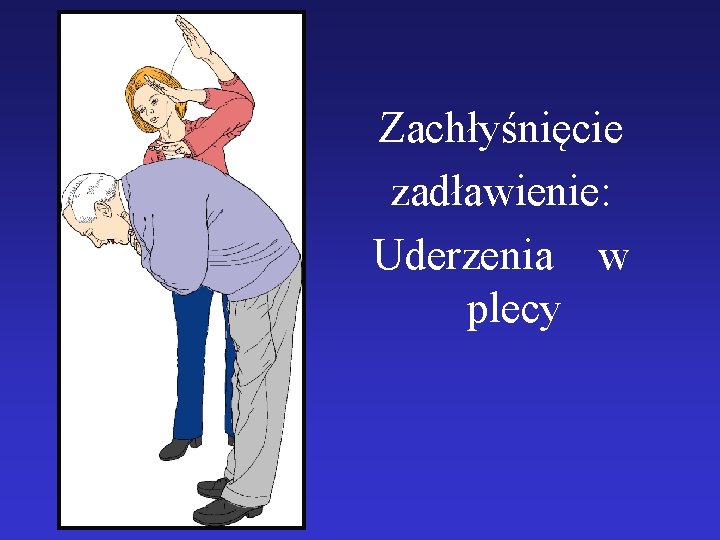 Zachłyśnięcie zadławienie: Uderzenia w plecy 