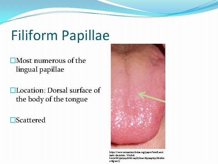 Filiform Papillae �Most numerous of the lingual papillae �Location: Dorsal surface of the body