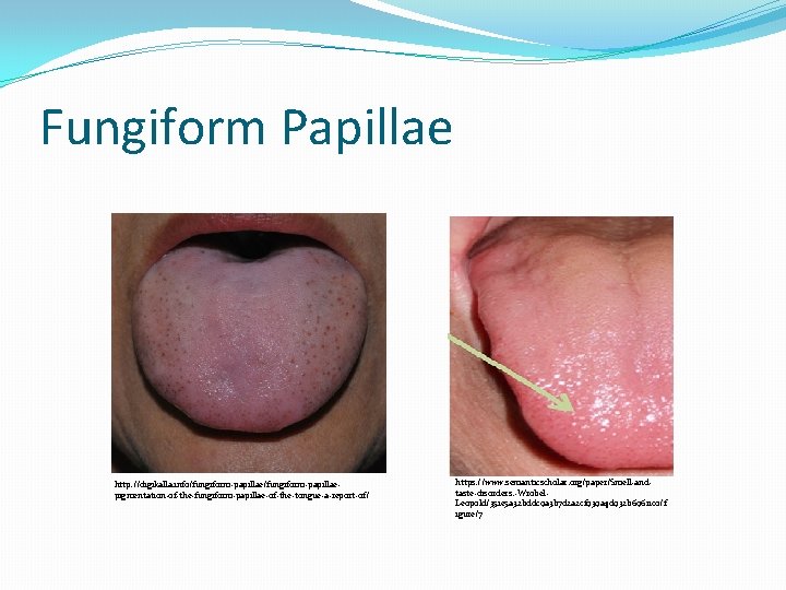 Fungiform Papillae http: //digikalla. info/fungiform-papillaepigmentation-of-the-fungiform-papillae-of-the-tongue-a-report-of/ https: //www. semanticscholar. org/paper/Smell-andtaste-disorders. -Wrobel. Leopold/351 e 5 a