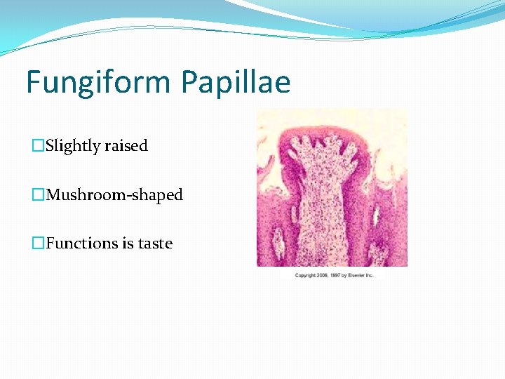 Fungiform Papillae �Slightly raised �Mushroom-shaped �Functions is taste 