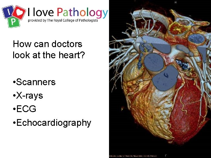 How can doctors look at the heart? • Scanners • X-rays • ECG •