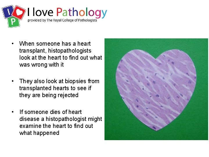  • When someone has a heart transplant, histopathologists look at the heart to